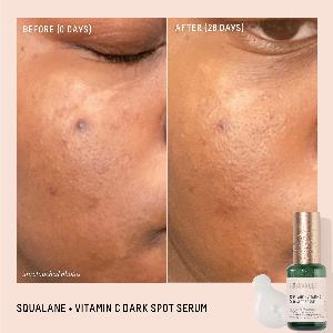 Squalane and Vitamin C Dark Spot Serum travel size now available for 18 25 off