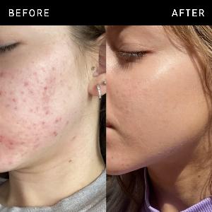 The INKEY List Niacinamide Serum 30ml