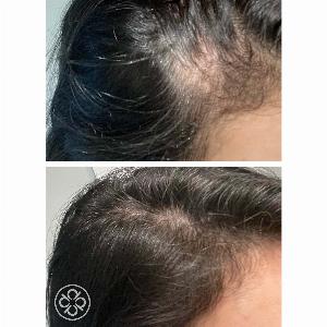 Hair Energize ExtraStrength Overnight Serum originally 82 now priced at 6560 offering 20 dis