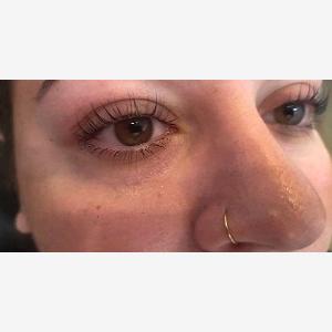 Wimpernverlängerung 11 oder 24DTechnik opt  Refill für 1 Person